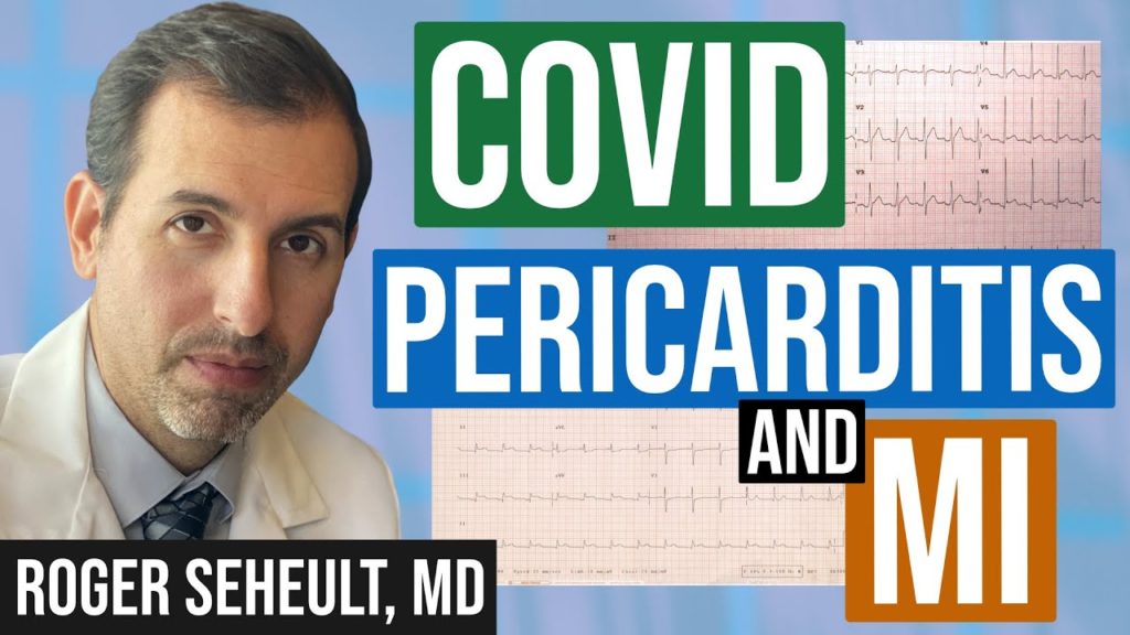 Covid pericarditis and MI on ECG and ultrasound